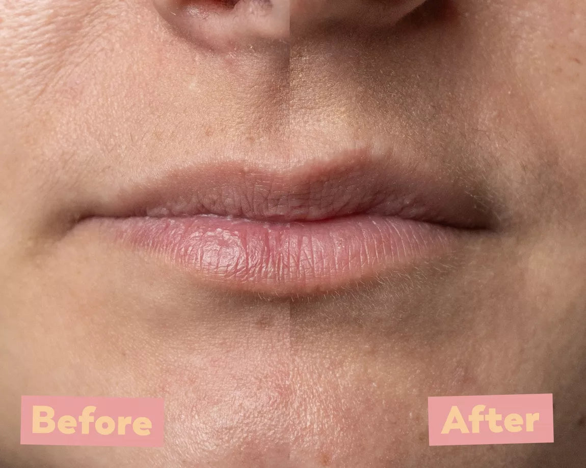 LŪPŲ PILINGAS "GREEN APPLE", 10ml